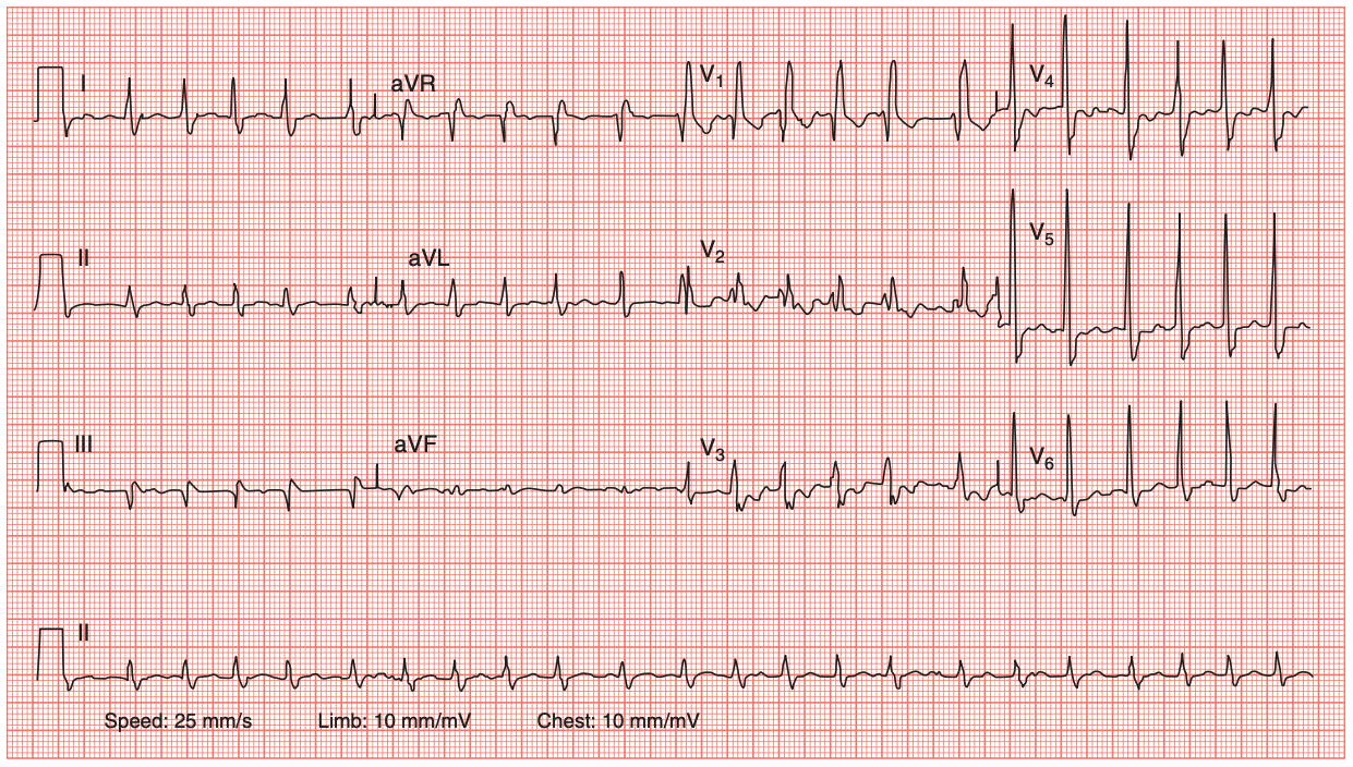 ecg_example2.png